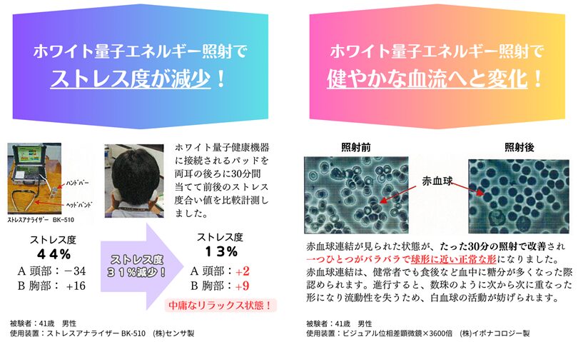 ホワイト量子エネルギーの効果イメージ